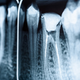 Man, you do not want to see dead tooth nerves on your dental x-ray. (Image: Radu Bercan/Shutterstock)